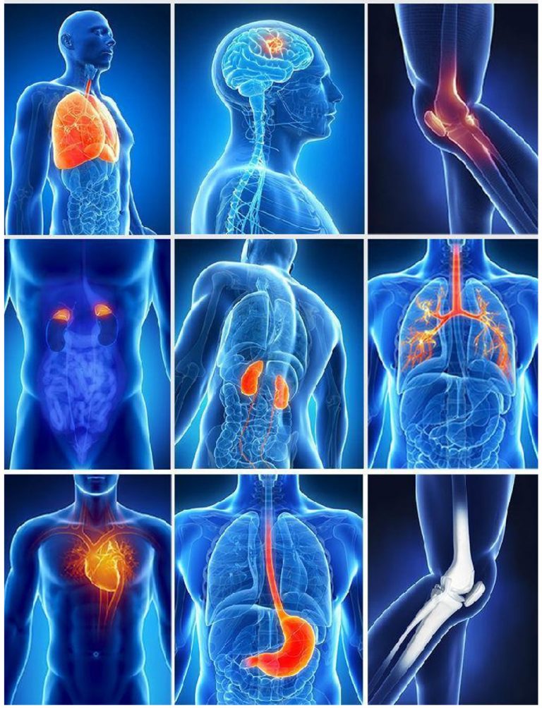 Diagnóstico de Ressonância Magnética Quântica - Elisabete Milheiro